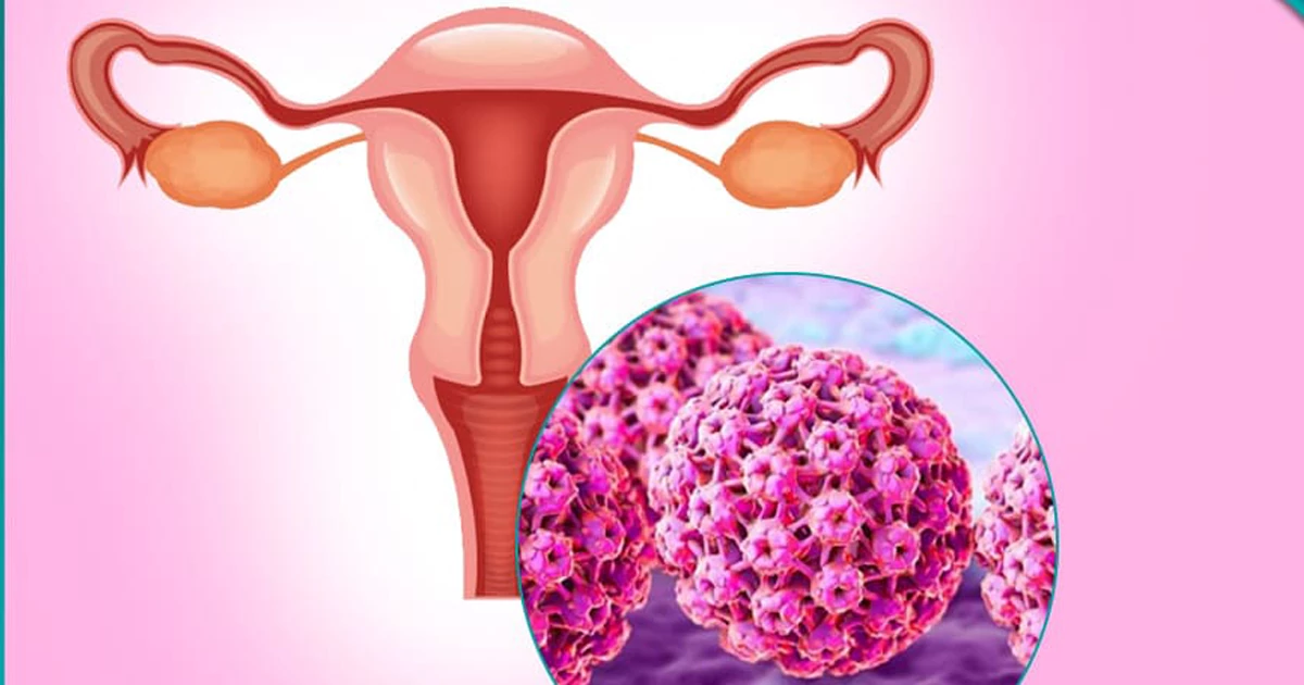 زگیل تناسلی چگونه ایجاد می‌شود؟