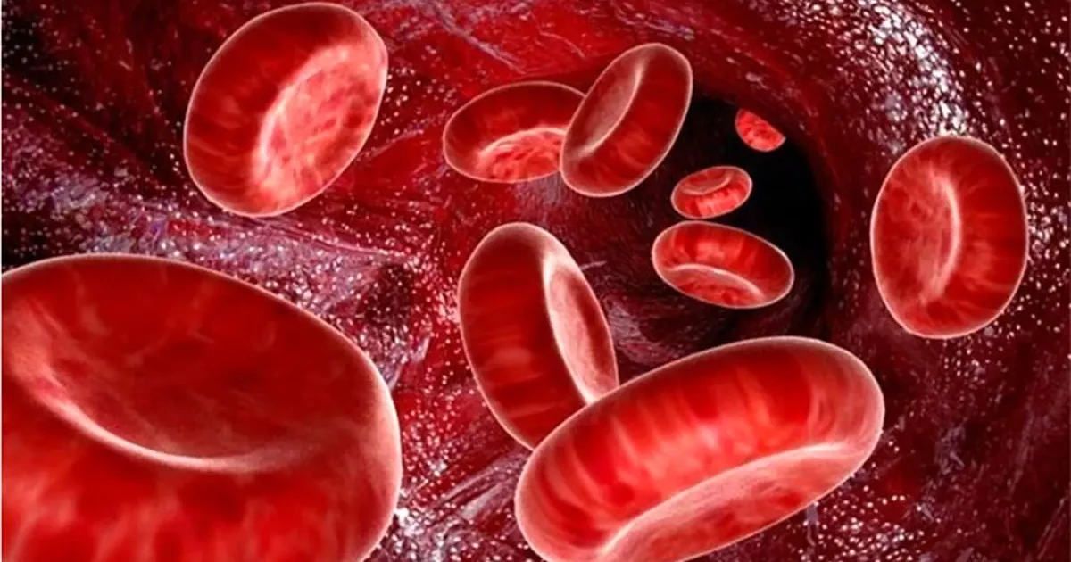 تشخیص کم‌خونی در کودکان