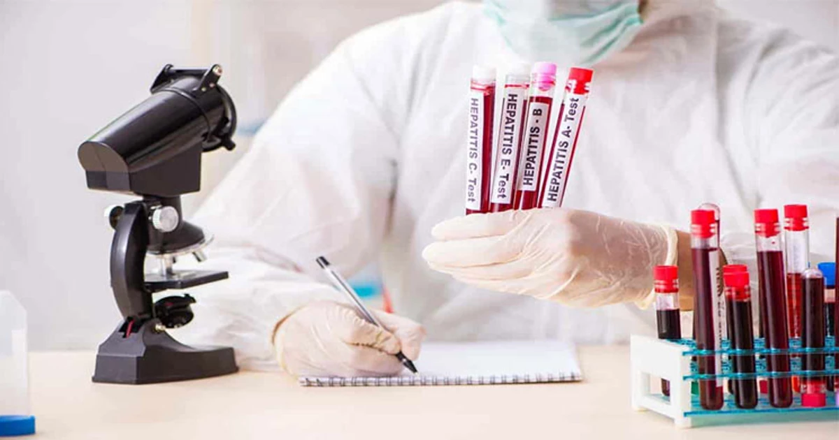 آزمایش و تست هپاتیت