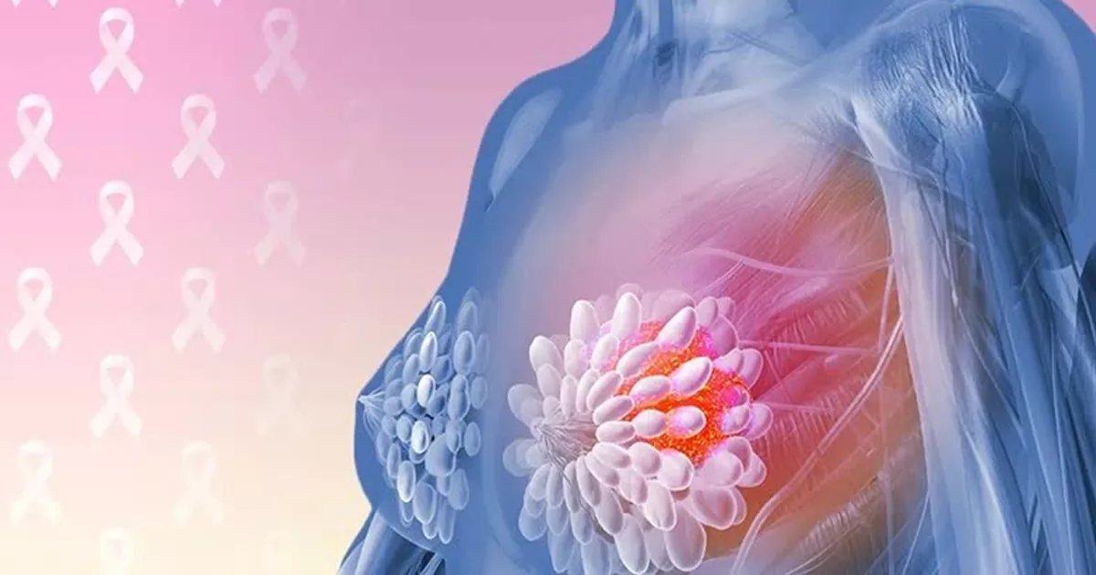 عوامل خطر و علائم سرطان سینه در زنان
