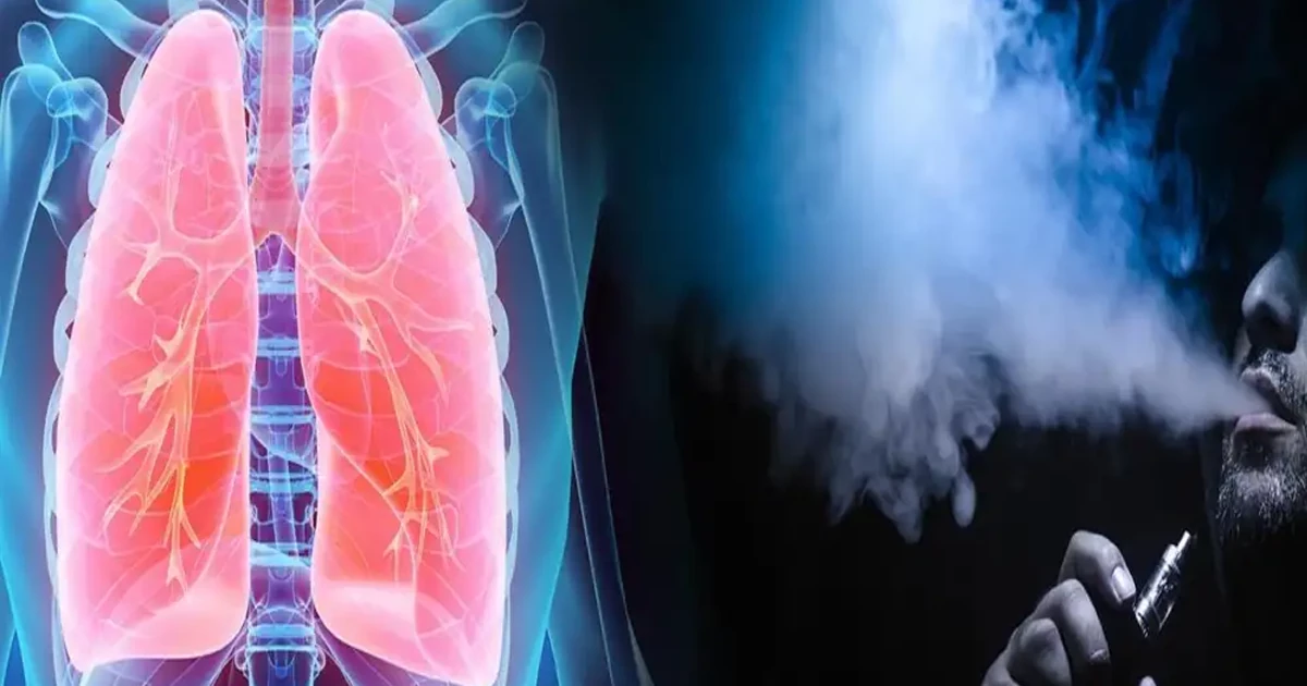 عوارض شدید ریوی در نوجوانان مصرف کننده ویپ