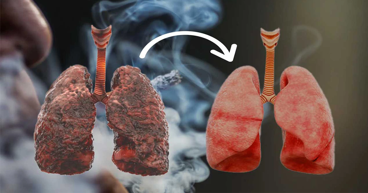 ویپ و خطر سرطان ریه