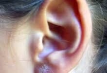 سوراخ کردن گوش