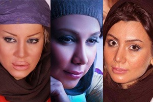 جراحی زیبایی در ستاره های سینمای ایران 