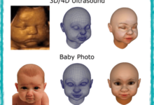 جنین سونوگرافی کودک