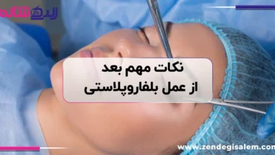 نکات مهم بعد از عمل بلفاروپلاستی، راهنمای کامل مراقبت‌ های بعد از جراحی پلک