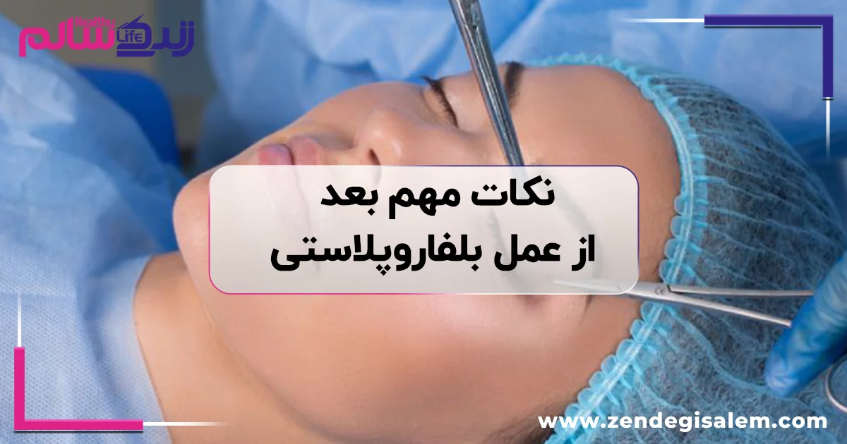نکات مهم بعد از عمل بلفاروپلاستی، راهنمای کامل مراقبت های بعد از جراحی پلک