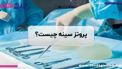 پروتز سینه چیست؟ بررسی کامل انواع و عوارض جراحی زیبایی سینه