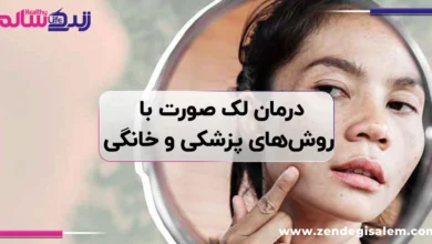 درمان لک صورت با روش‌های پزشکی و خانگی، راهنمای کامل از بین بردن لک