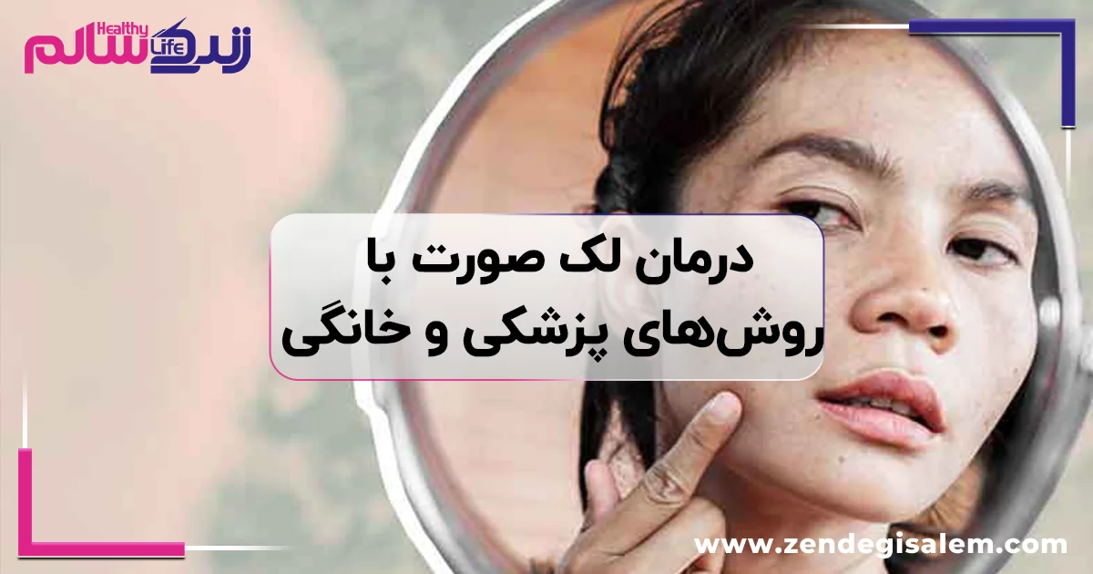 درمان لک صورت با روشهای پزشکی و خانگی، راهنمای کامل از بین بردن لک