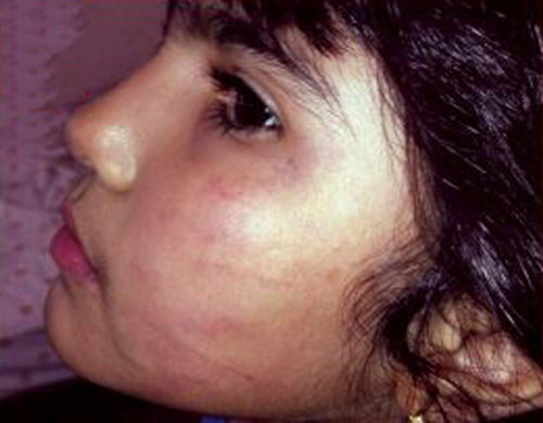 ضرب و شتم کودک 6 ساله توسط دندانپزشک