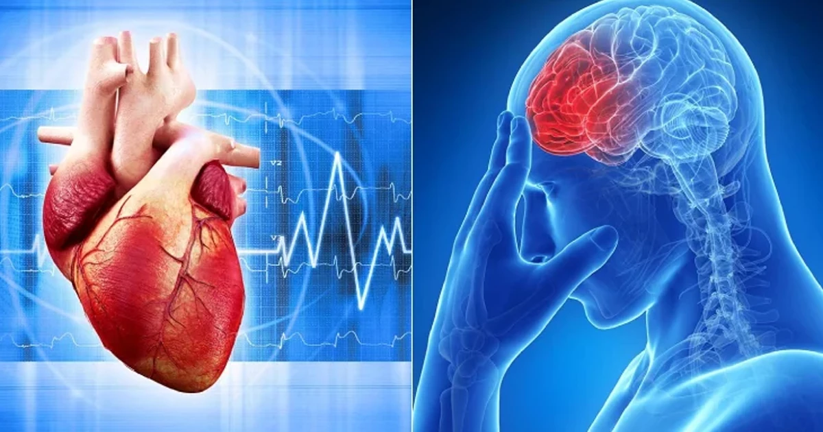 چه تفاوتی بین سکته‌های قلبی و مغزی وجود دارد؟