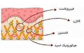 کلاژن سازی آسان و ارزان