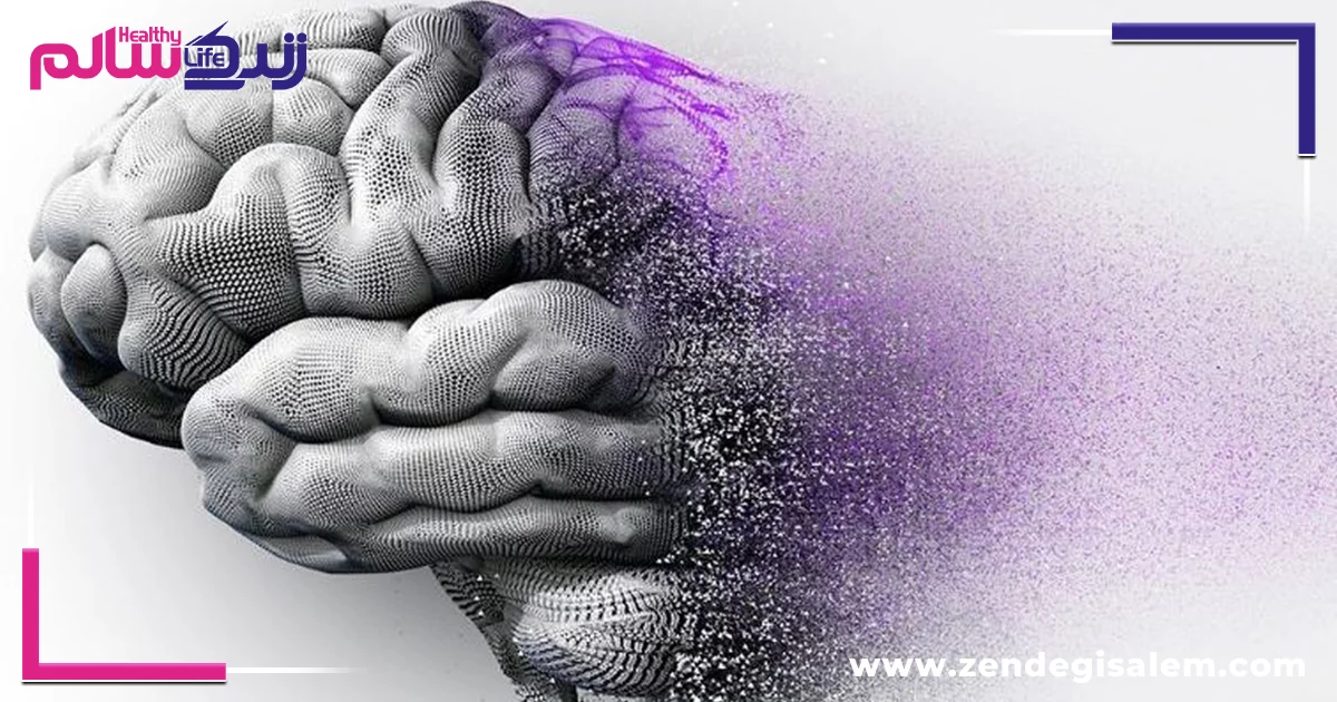 علائم اولیه آلزایمر