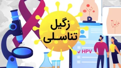 زگیل تناسلی در آقایان و خانم‌ها