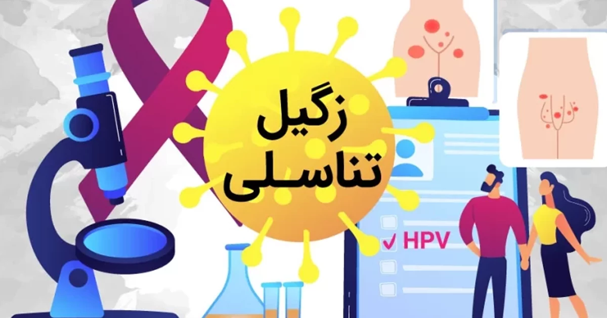 زگیل تناسلی در آقایان و خانم‌ها