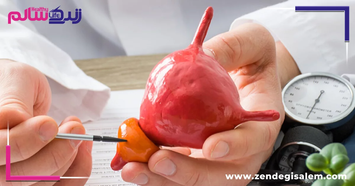 غذاهای مضر برای پروستات