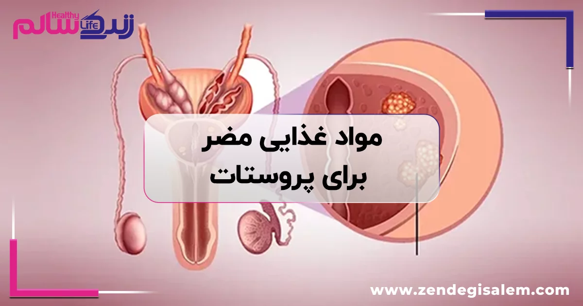 مواد غذایی مضر برای پروستات؛ ۱۳ خوراکی که بهتر است کمتر مصرف کنید