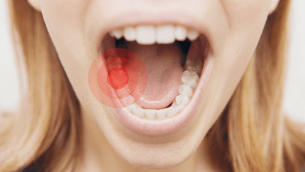 درمان خانگی دندان‌درد