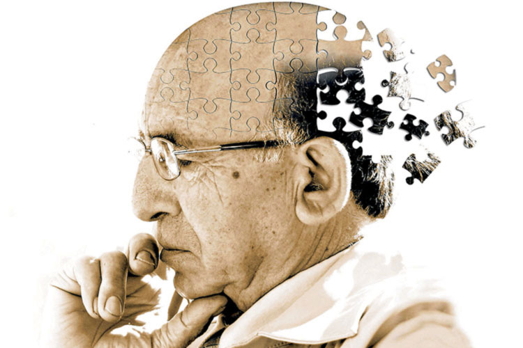 آلزایمر و زوال عقل
