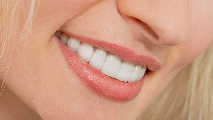 انواع روش‌های سفید کردن دندان