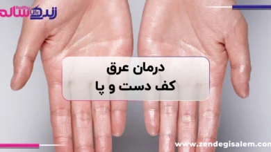 عرق کف دست و پا، علت، درمان، روش‌های خانگی و راه‌های جلوگیری از تعریق زیاد