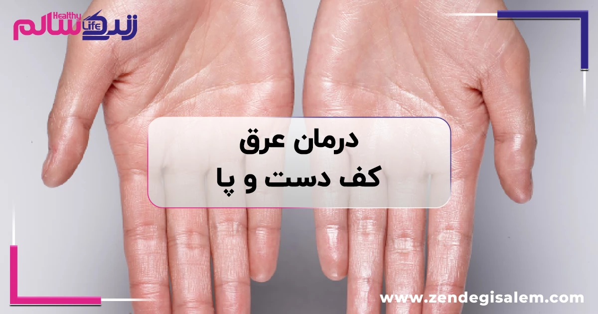 عرق کف دست و پا، علت، درمان، روشهای خانگی و راههای جلوگیری از تعریق زیاد