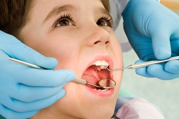 درمان پوسیدگی دندان در کودکان