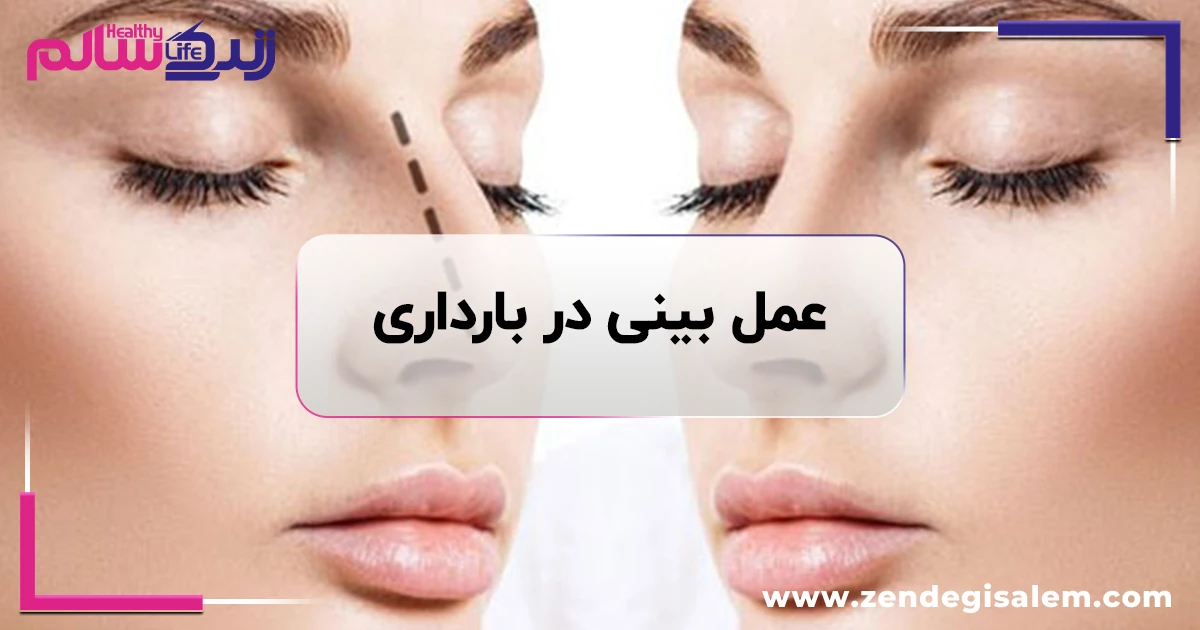 عمل بینی در دوران بارداری؛ هر آنچه باید درباره رینوپلاستی و حاملگی بدانید