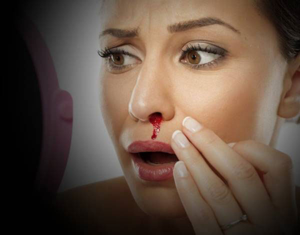 stop nose bleeding