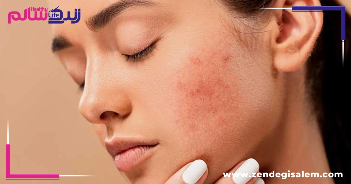 چگونه تاثیرات استرس بر بدن را کاهش دهیم