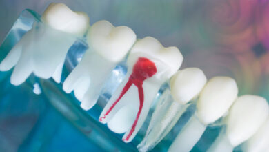 علت دندان درد بعد از عصب کشی
