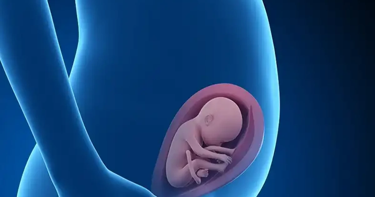 پیشگیری از نارسایی دهانه رحم