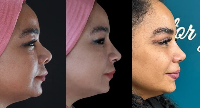 مرکز اسکن سه بعدی راوانا