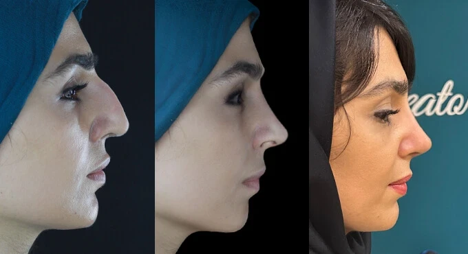 مرکز اسکن سه‌بعدی راوانا برای جراحی بینی
