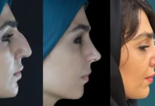 اسکن سه‌بعدی، مهم‌ترین قدم قبل از جراحی بین