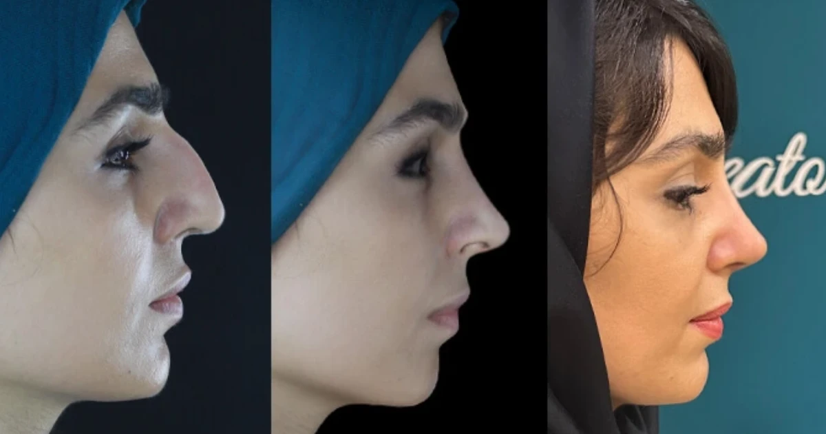اسکن سه‌بعدی، مهم‌ترین قدم قبل از جراحی بین