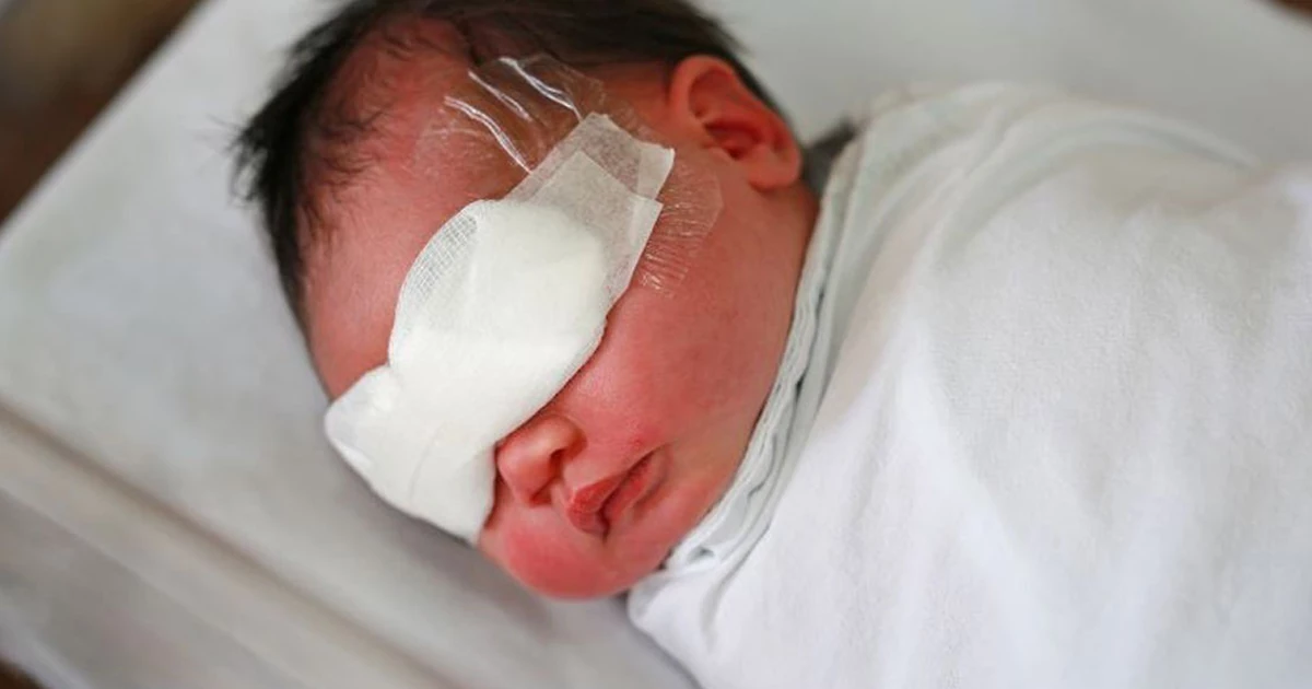 روند مراقبت و ارجاع برای رتینوپاتی در نوزادان نارس