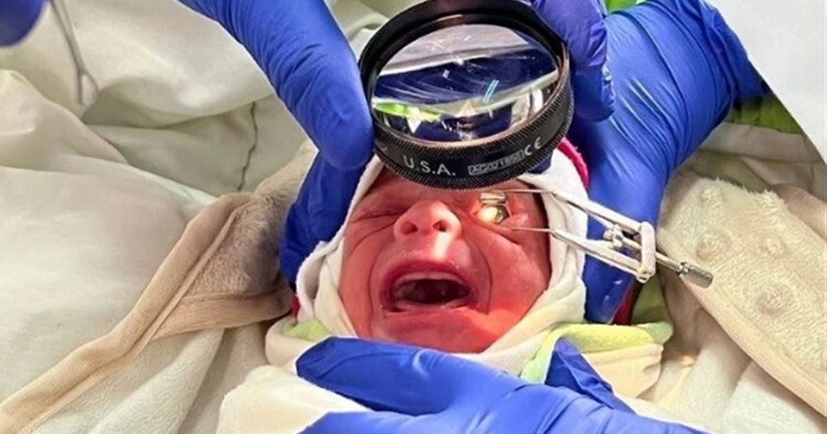 بیماری شبکیه (رتینوپاتی) در نوزادان نارس