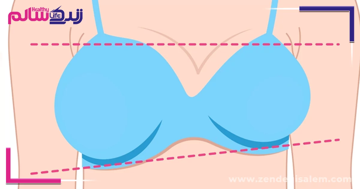 غیر قرینگی سینه از علائم سرطان سینه