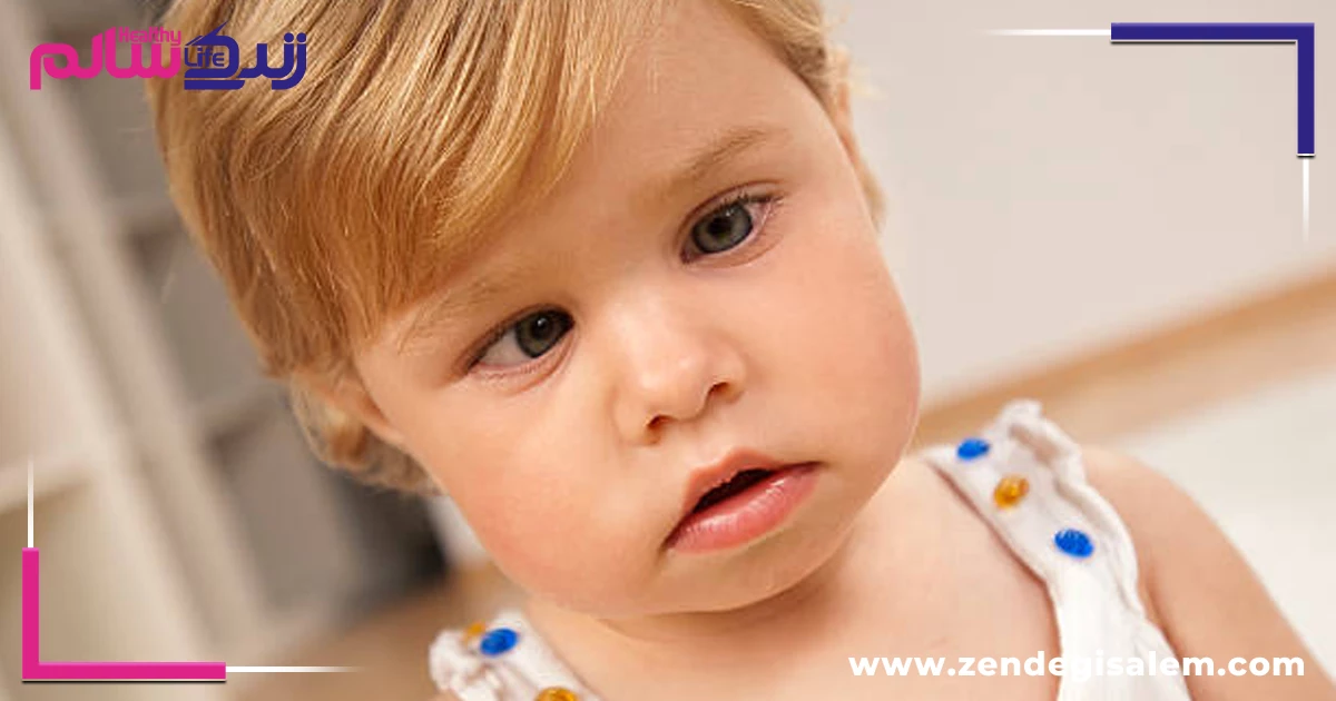 درمان انحراف چشم در کودکان