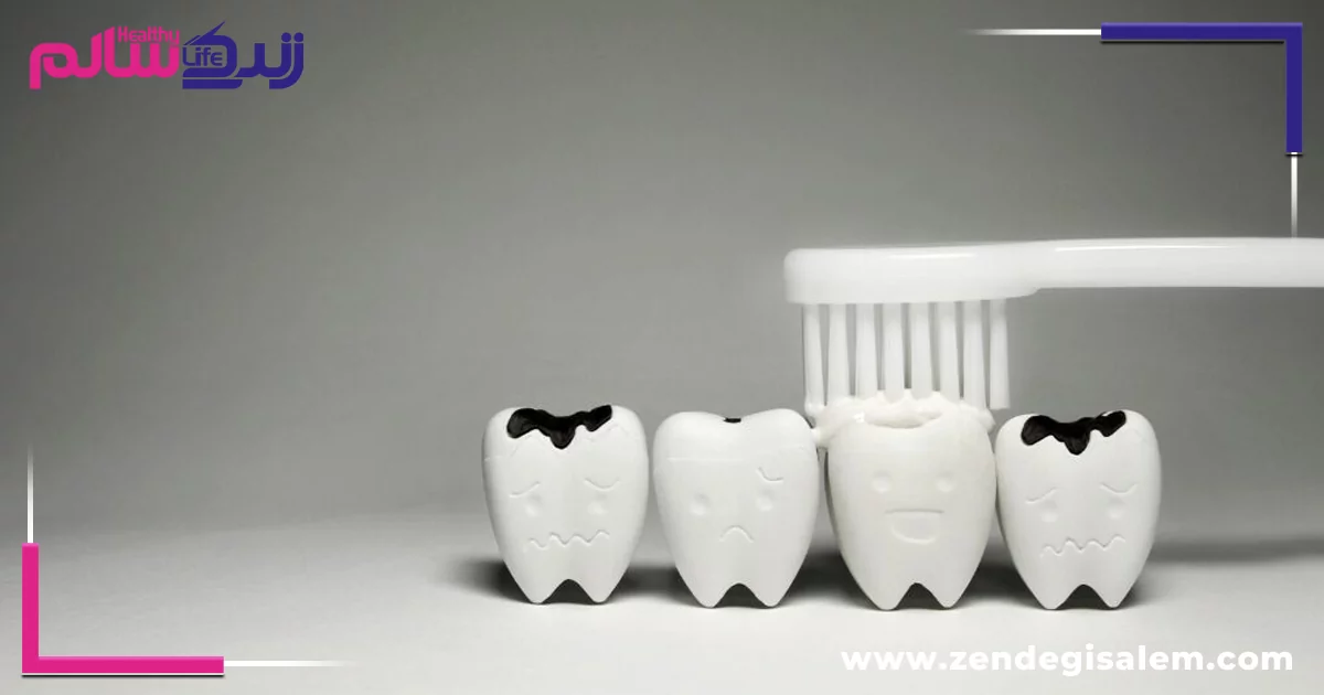 پیشگیری از پوسیدگی دندان: روش‌های کلیدی