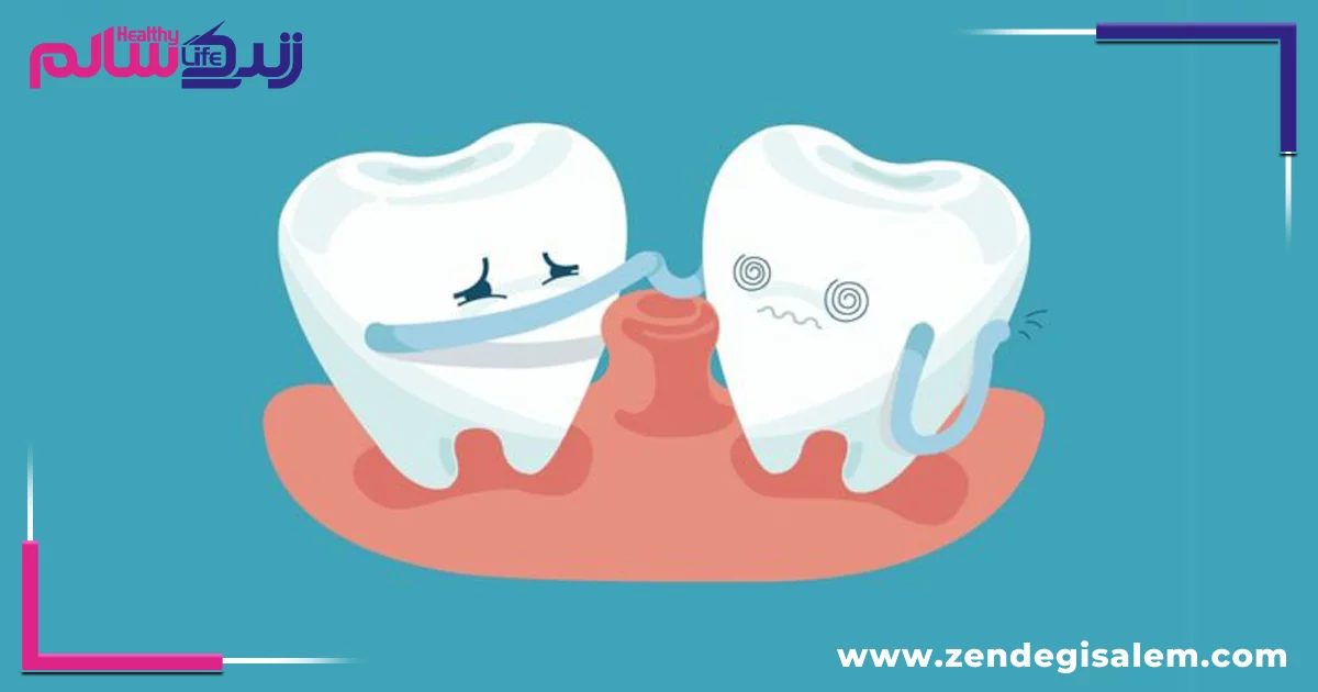 آمار و تأثیرات پوسیدگی دندان در ایران