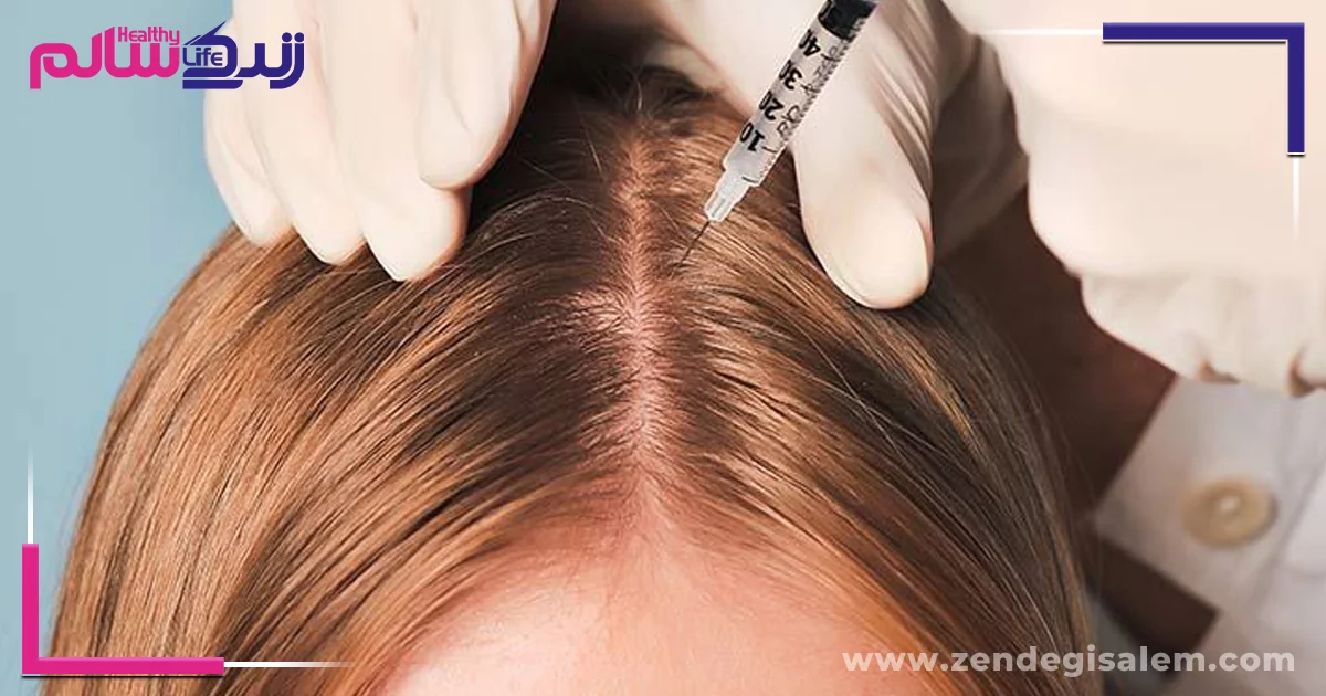 روشهای کلینیکی و تزریقی برای درمان ریزش مو