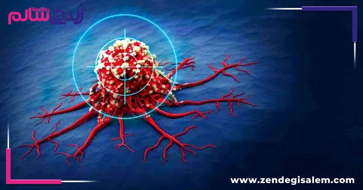 علائم هشدار دهنده انواع سرطان