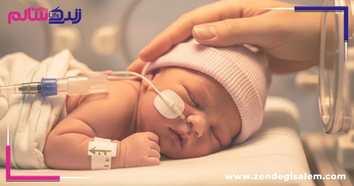 علائم زردی در کودکان