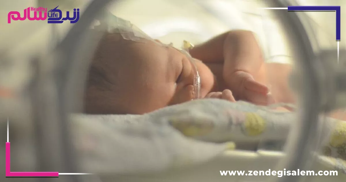 برای زردی نوزاد چه باید کرد؟