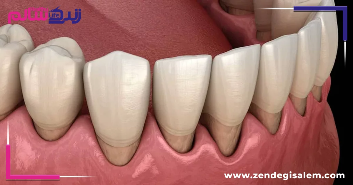 نکات کلیدی روش صحیح مسواک زدن