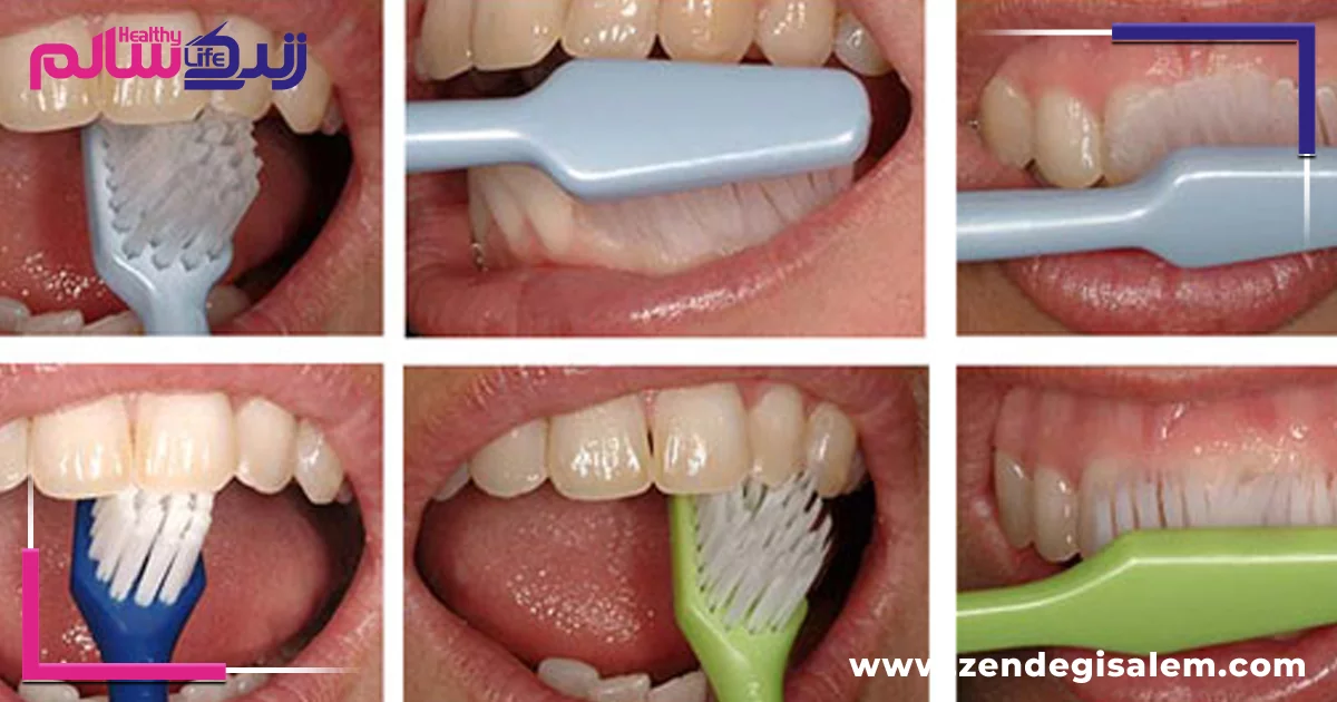 مراحل صحیح مسواک زدن