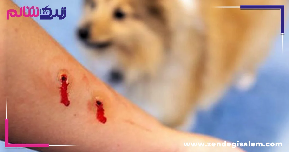 بعد از گاز گرفتگی حیوان چه باید کرد؟